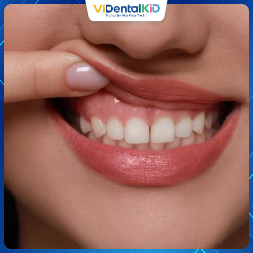 Nướu răng có vị trí khá quan trọng đối với răng miệng
