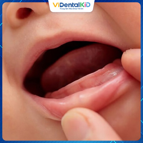 Những dấu hiệu cho thấy trẻ bắt đầu mọc răng
