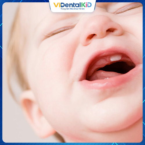 Trẻ mọc răng sốt mấy ngày là câu hỏi của không ít bậc phụ huynh