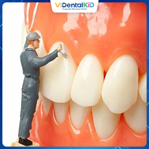 Lấy cao răng giúp hạn chế viêm nha chu phát triển