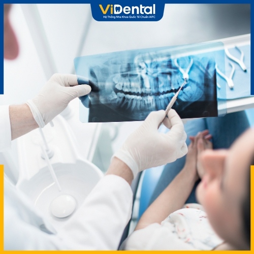 Chụp X-quang răng là một công cụ quan trọng trong điều trị nha khoa