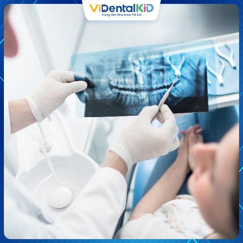 Chụp X-quang răng là một công cụ quan trọng trong điều trị nha khoa