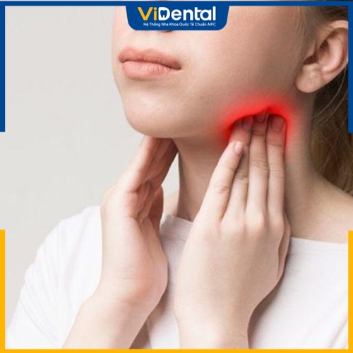 Trường hợp đau nhức răng kèm theo hạch sưng to phải điều trị nha khoa