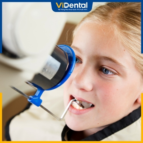Yếu tố đánh giá chất lượng chụp X-quang răng