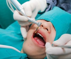 Mỗi nha khoa có chính sách giá trồng răng không giống nhau