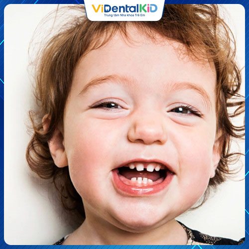 Chú ý thời điểm thay răng sữa để giúp răng trẻ mọc đều